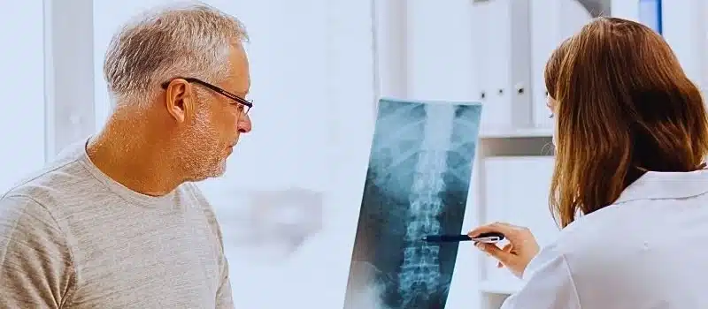 doctor with spine x-ray and senior man at hospital. spinal cord injury levels
