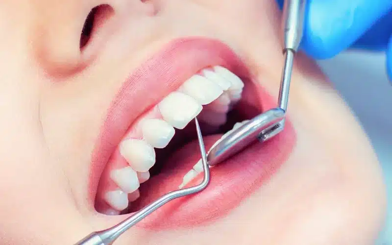 Healthy teeth of a woman being checked by a dentist.